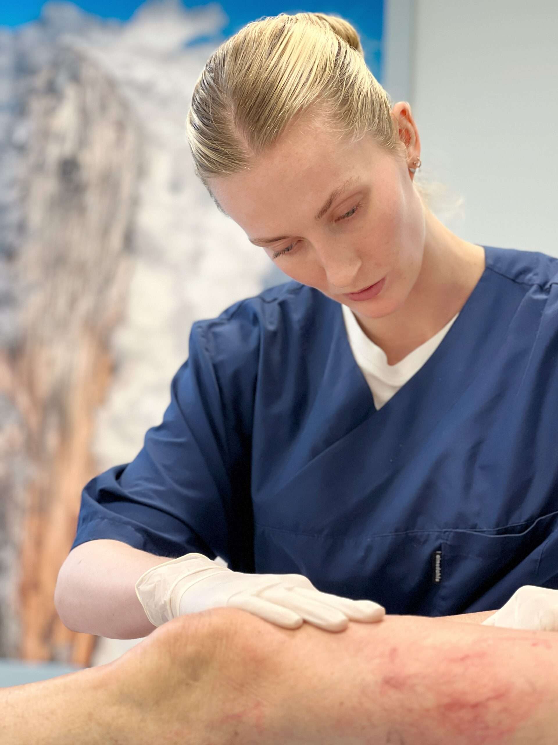 Pasient under sklerosering av sprengte blodkar